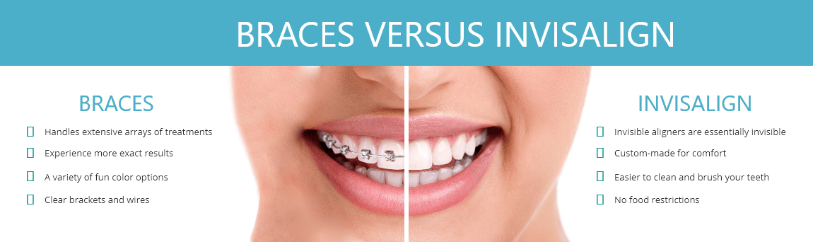 Chart comparing traditional braces and Invisalign