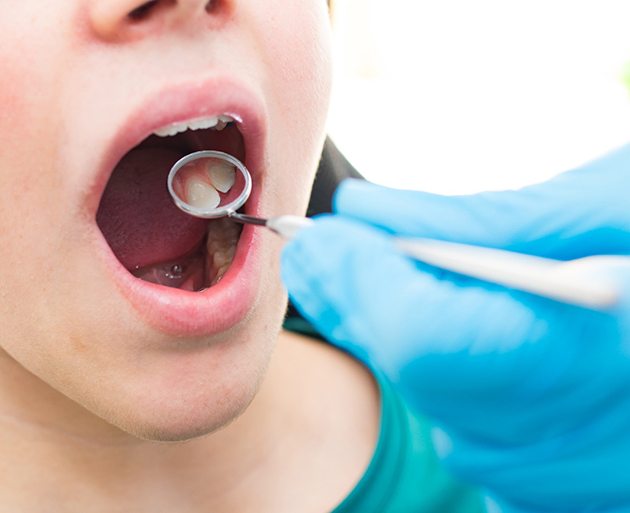 a pediatric dentist looking at a teen’s teeth