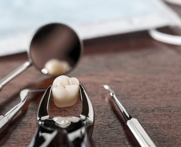 an extracted tooth on a table with dental tools