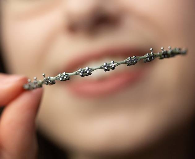 Girl blurry in background holding row of braces with wire in the foreground