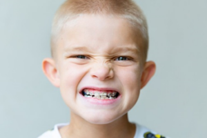 Little boy grimacing while wearing braces