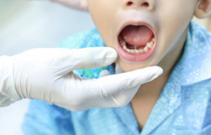 Dentist examining a child’s teeth